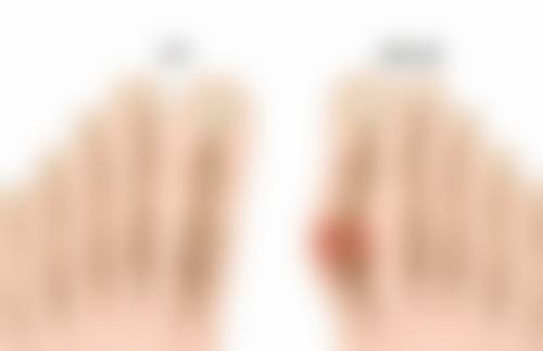 机构等级对毛发种植费用有什么影响?