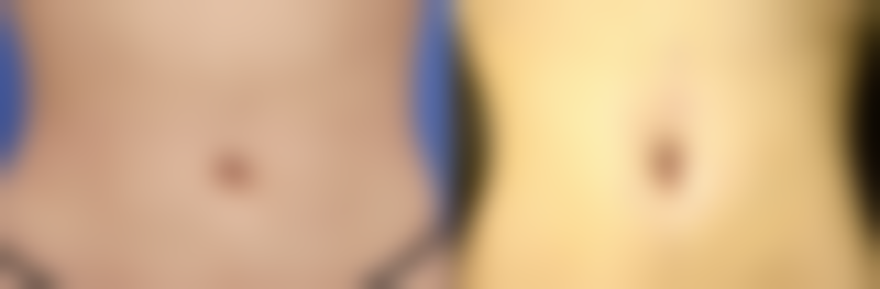 常熟瑞丽美贝尔美容医院口碑评价怎么样？