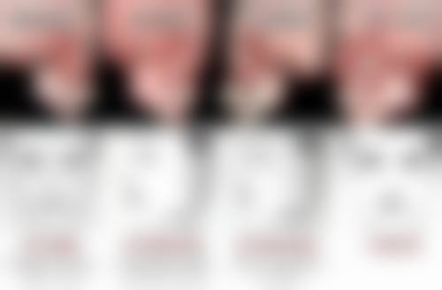 割双眼皮后饮食还有哪些营养搭配的要点?