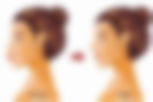 个体差异会怎样影响修复时间呢？