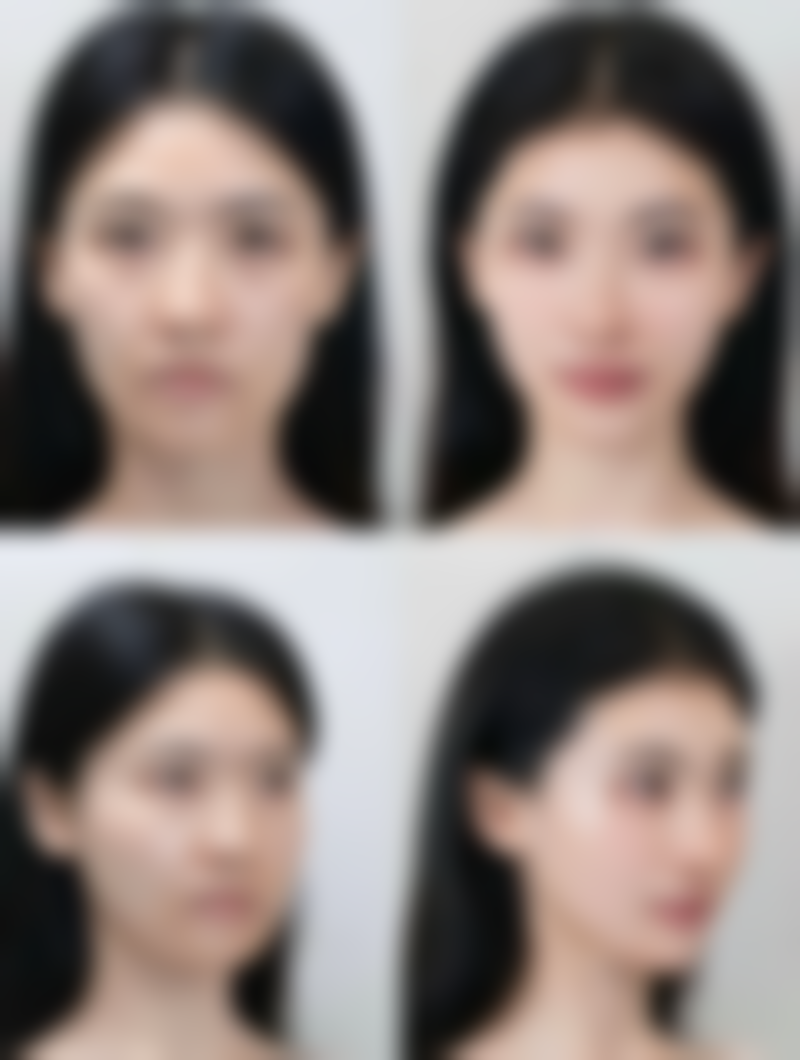 合肥第一人民医院整形美容分院口碑评价怎么样？