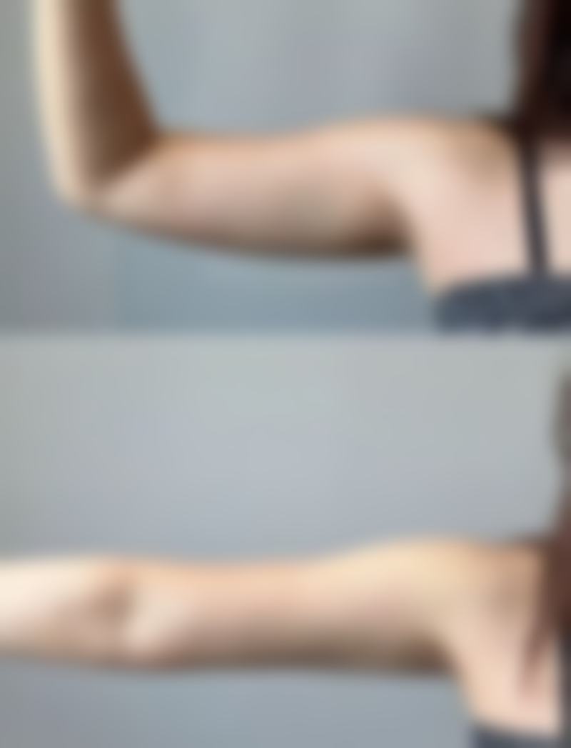 福州曙光整形医院怎么预约