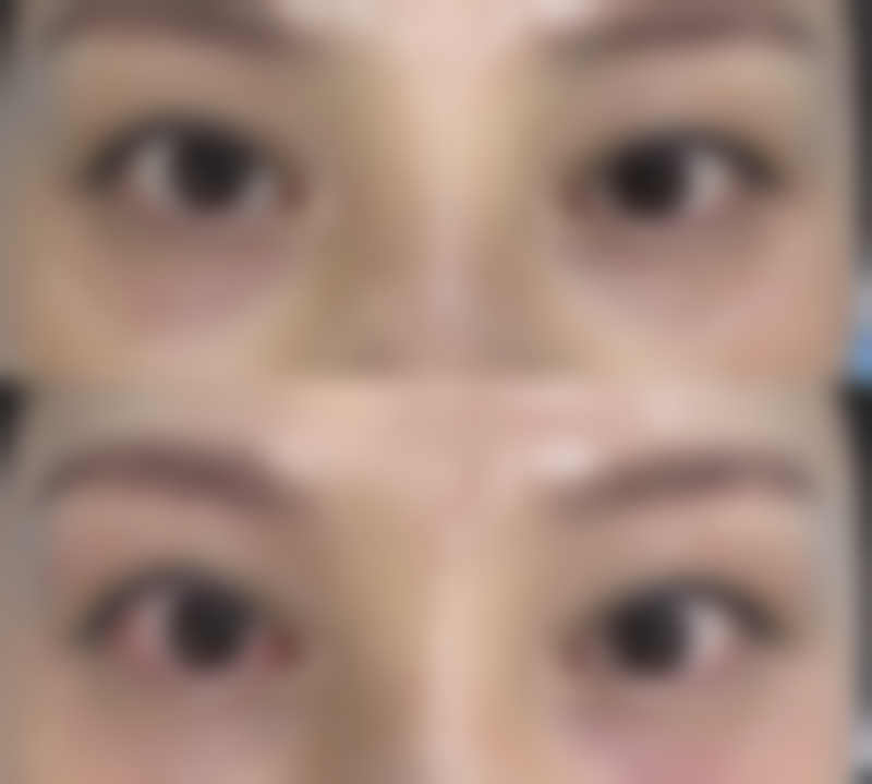 长春朗妍整形医院正规吗？