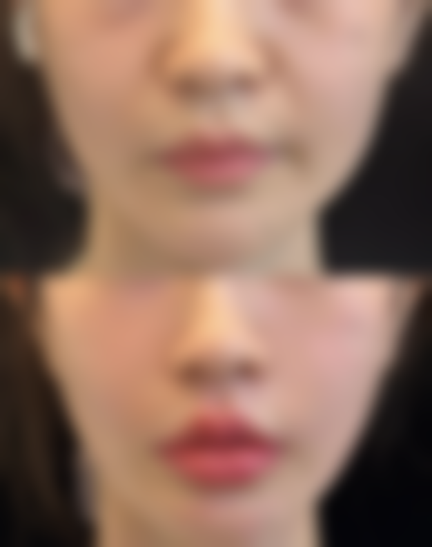 济南蓝白整形医院口碑评价怎么样?