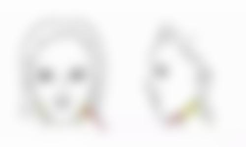 韩国GOOD FILLER整形外科医院口碑评价怎么样？