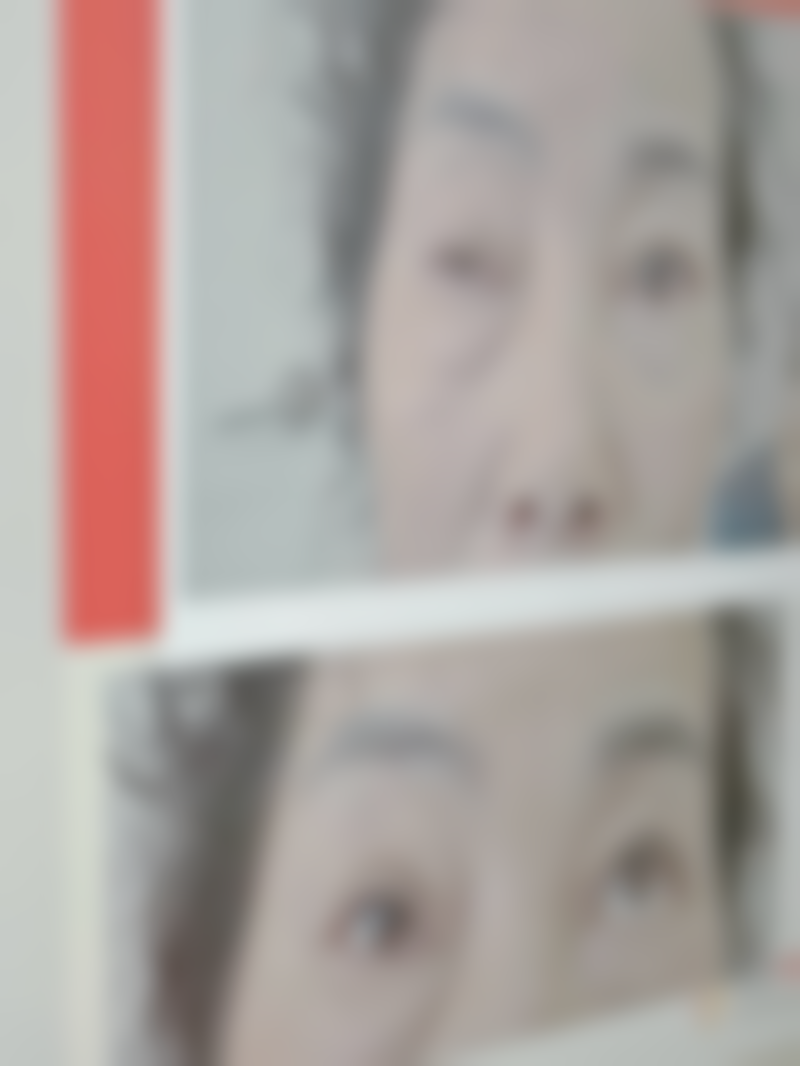 韩国GOOD FILLER整形外科医院怎么预约