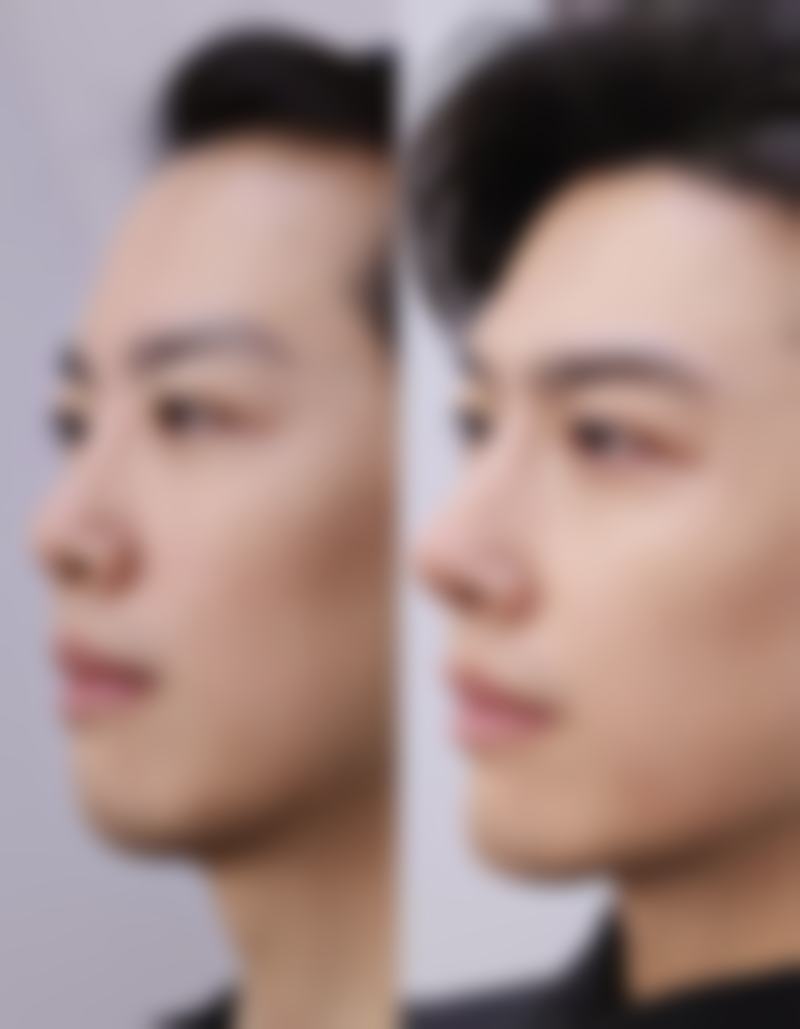 北京艺美硕德医疗美容医院正规吗？