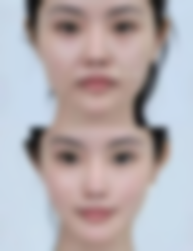 昆明BBH珠玑医疗美容门诊部怎么预约