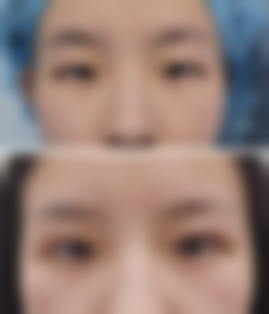 韩国GOOD FILLER整形外科医院正规吗？