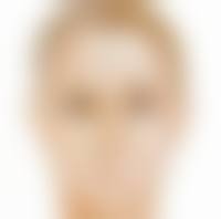 眼睑下垂和双眼皮手术后，修复时间大概多久，有哪些注意事项？