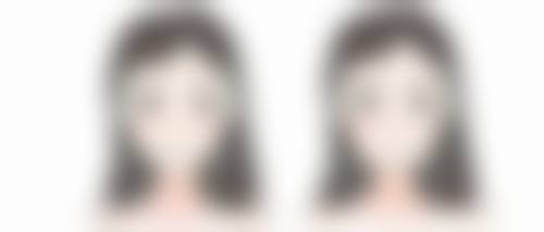 做眼睑下垂和双眼皮手术，医院该怎么选？