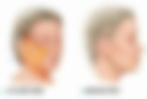 问题四：居家护理与自然疗法有哪些实用方法和好处？