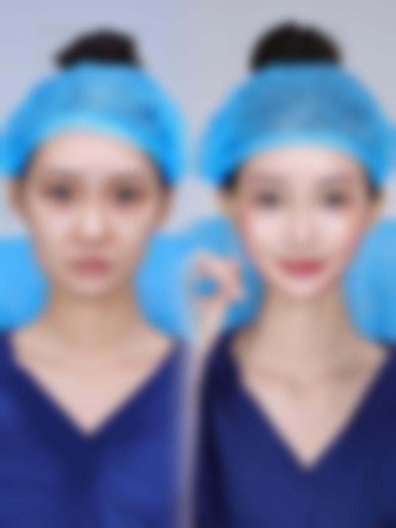 四川美莱美容医院正规吗？