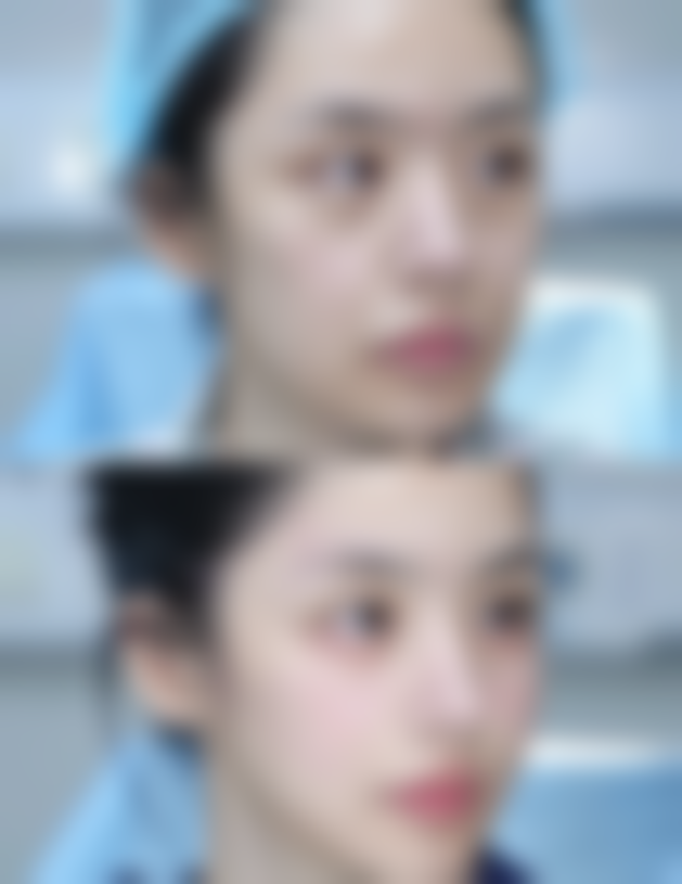 韩国延世eyes整形外科正规吗？