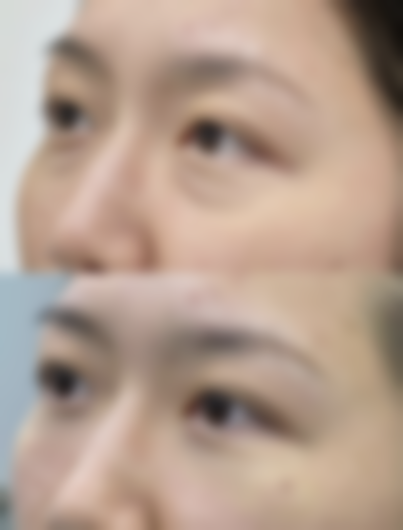 深圳金嬉微创医疗美容诊所怎么预约