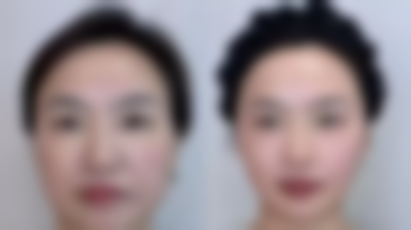 北京欧扬整形医疗美容门诊部怎么预约