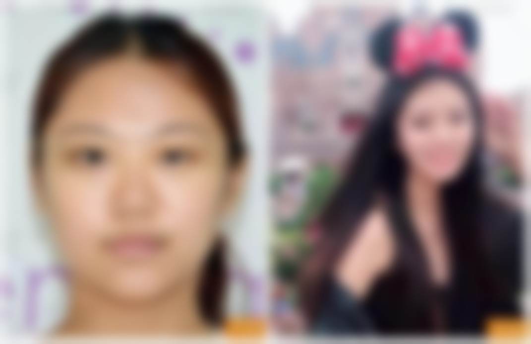 北京禾美嘉医疗美容门诊部任学会：手术技术见真章