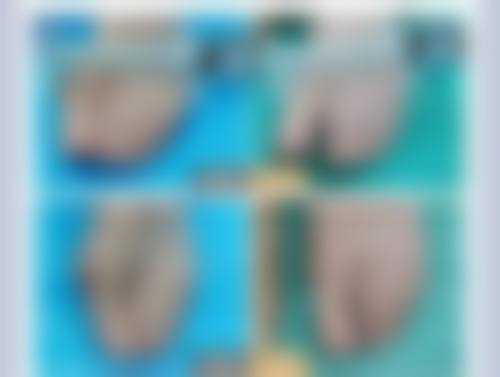 不同修复阶段有什么护理建议？