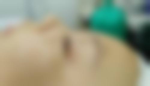 合肥第一人民医院整形美容分院青纪鸿医生患者评价