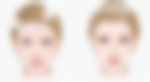 抽脂后皮肤感觉异常能修复吗？