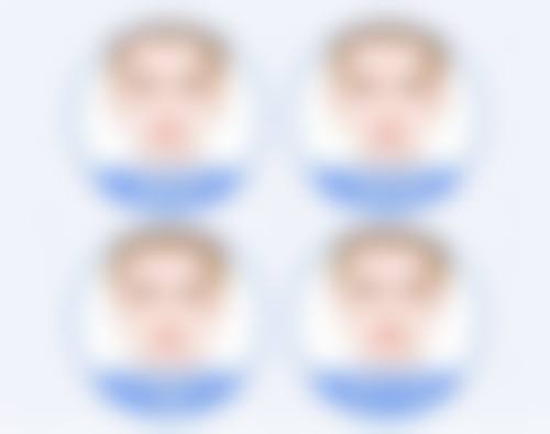 做完眼袋后卧蚕多久能长出来？揭秘恢复时间与护理技巧！恢复时间因人而异，护理有啥门道？ 