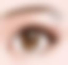 抽脂会导致深静脉血栓形成吗？