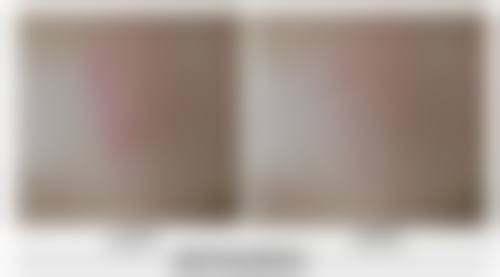 竹山仁爱医院医疗美容科正规吗？