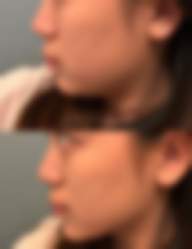 榆林誉美婕熹卡整形医院正规吗？