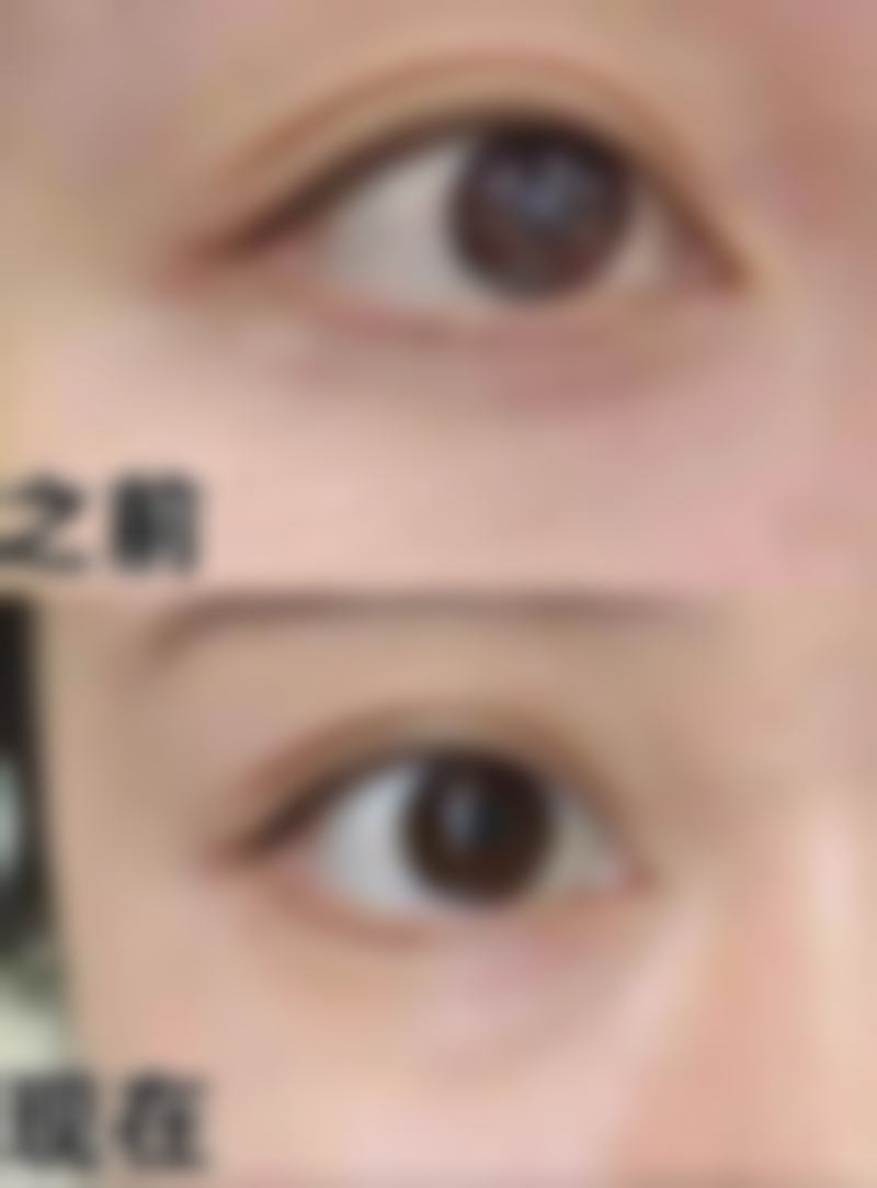 合肥第一人民医院整形美容分院青纪鸿医生收费价格