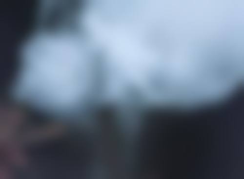 做双眼皮埋线有危险吗？专家告诉你真相与注意事项！埋线后护理要点及恢复时间是啥？ 