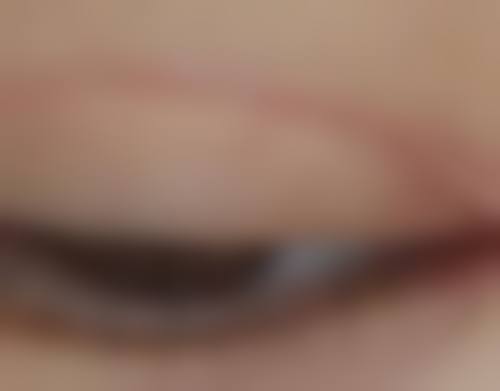 成都美黎美医疗美容整形门诊部怎么预约：