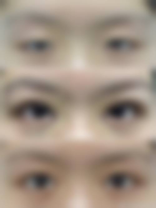 深圳阳光医疗美容医院徐小草医生患者评价