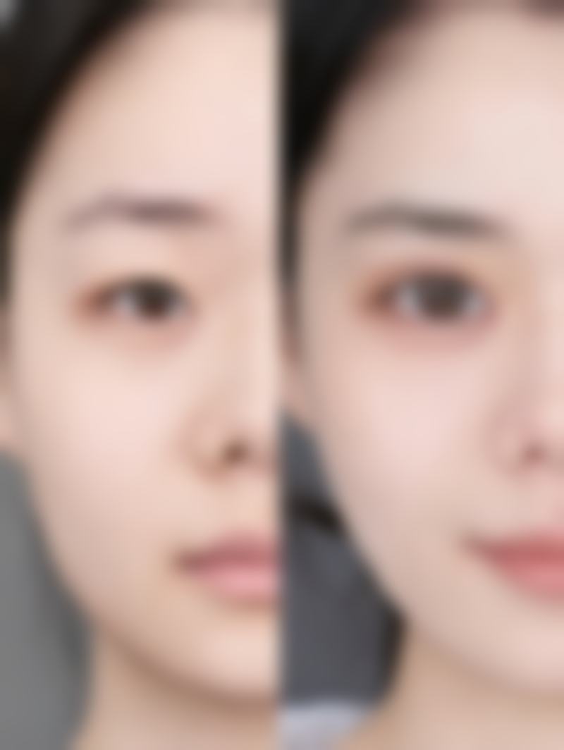 成都美黎美医疗美容整形门诊部口碑评价怎么样？