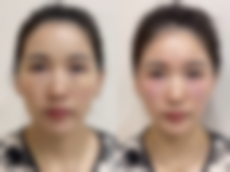 潍坊同齐整形医院怎么预约