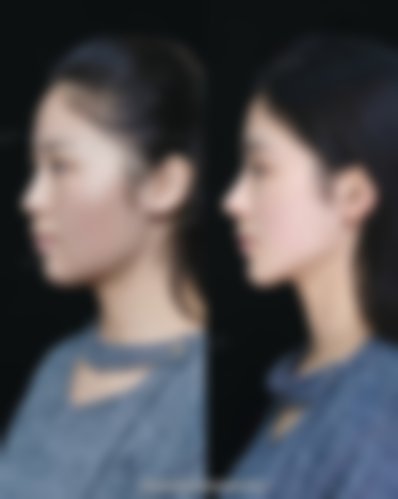 问题二:非医美调整方法中的作息管理是怎样的?