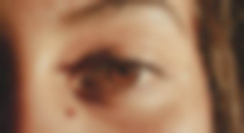 韩国知人jiin整形外科梁奎相医生擅长项目