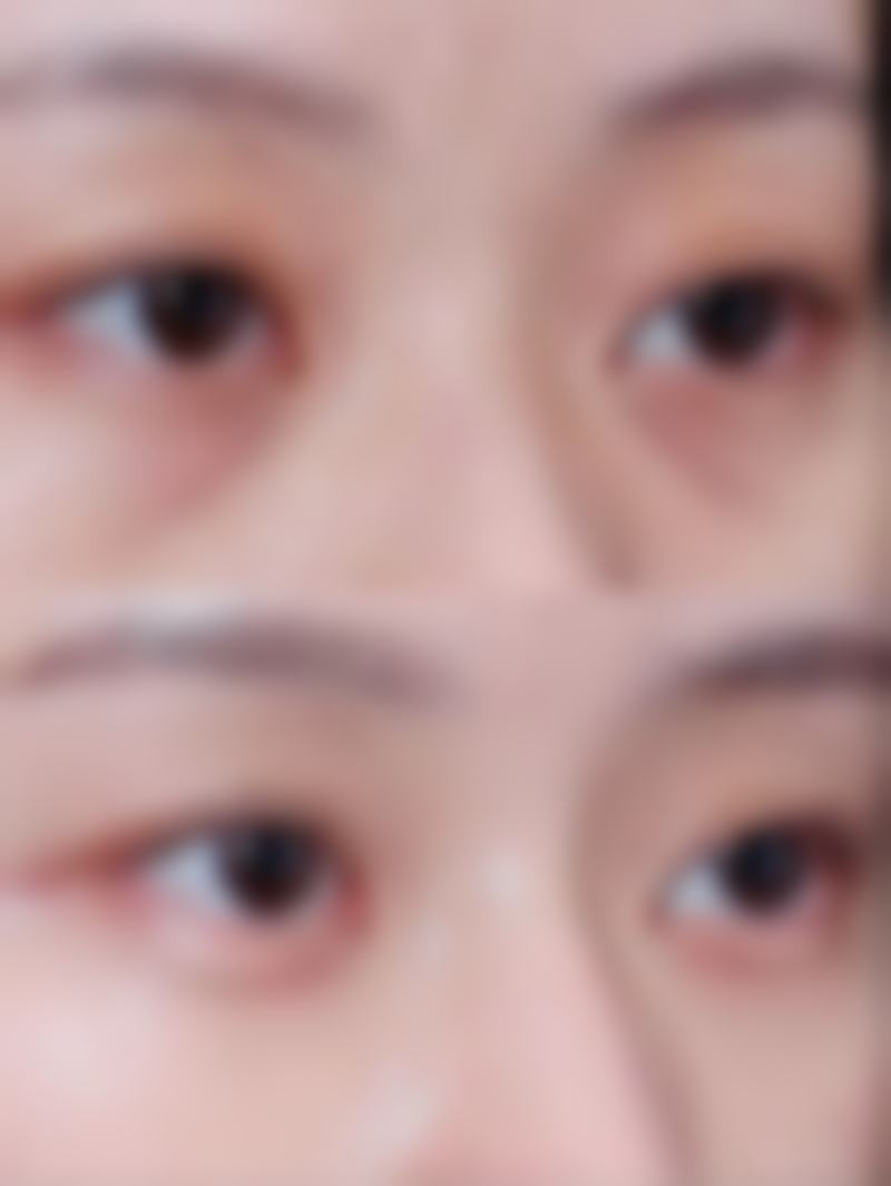 常熟瑞丽美贝尔美容医院王大明医生五官整形技术怎么样？