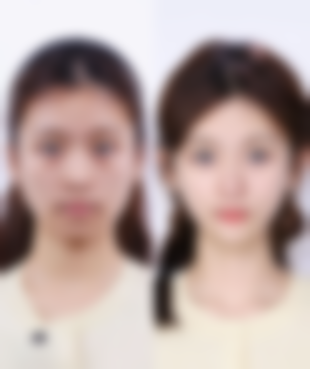 青岛美拓医疗美容怎么预约