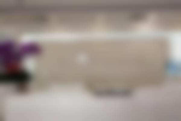 北京圣嘉新医疗美容医院颧骨内推术的技术优势有哪些？