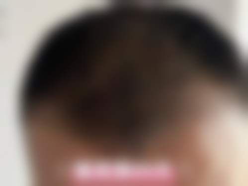 福州艾尚美医疗美容门诊部周镇龙医生患者评价