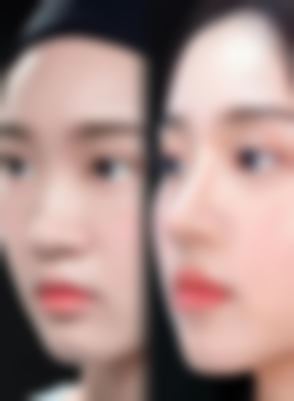 规范疤痕护理能消除拔罐烫伤疤痕吗？