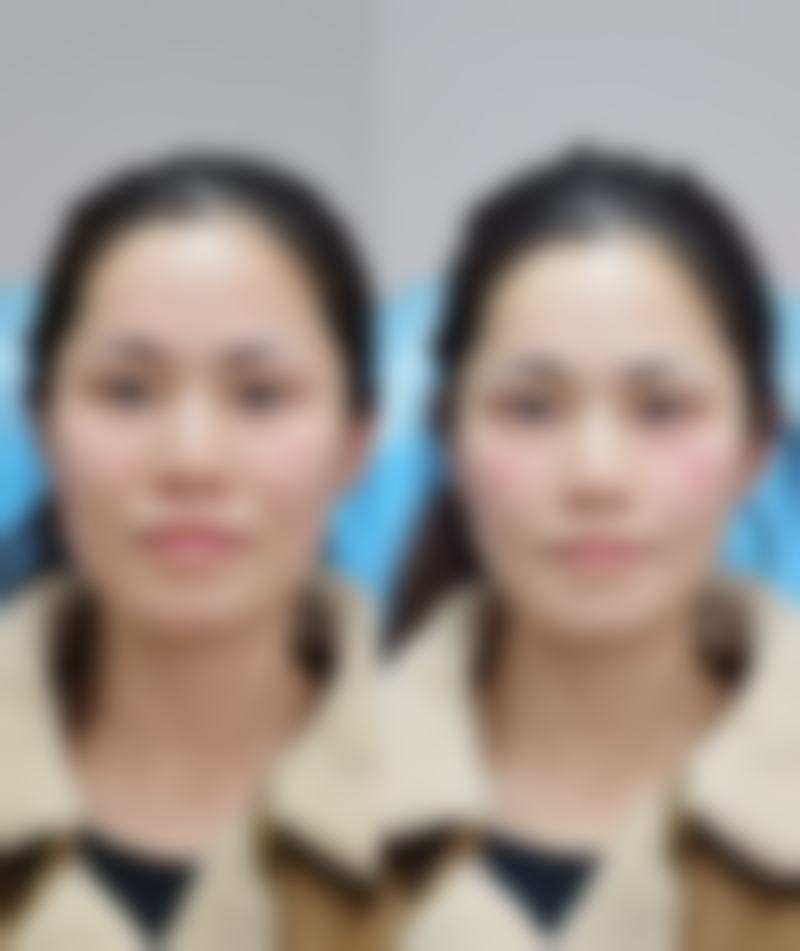 西安美立方医疗美容医院口碑评价怎么样?