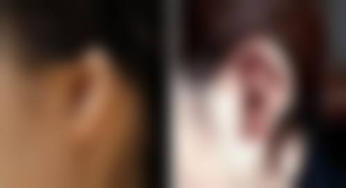 漳州维多利亚医疗美容门诊部陈淑端医生收费价格