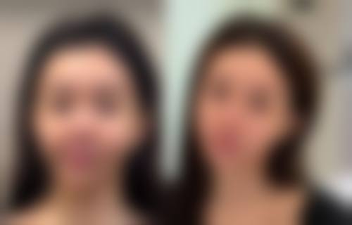 悦罗兰咖啡因紧致抗皱眼霜去除眼袋成效如何？