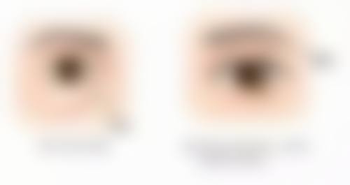 金华因皙嘉美整形医院口碑评价怎么样？