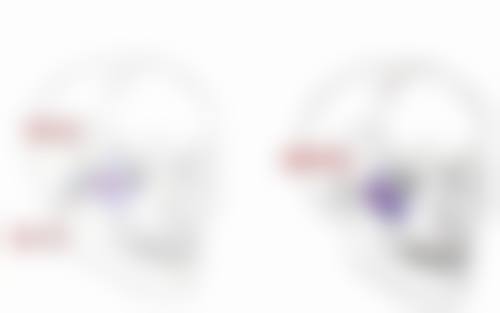 瑾妍萃紧致淡纹眼霜能改善顽固型眼袋吗？