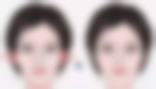 无锡爱思特整形美容医院如何怎么预约