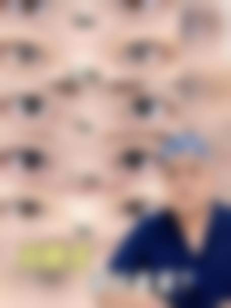 深圳阳光医疗美容医院张起准医生注射除皱技术怎么样？