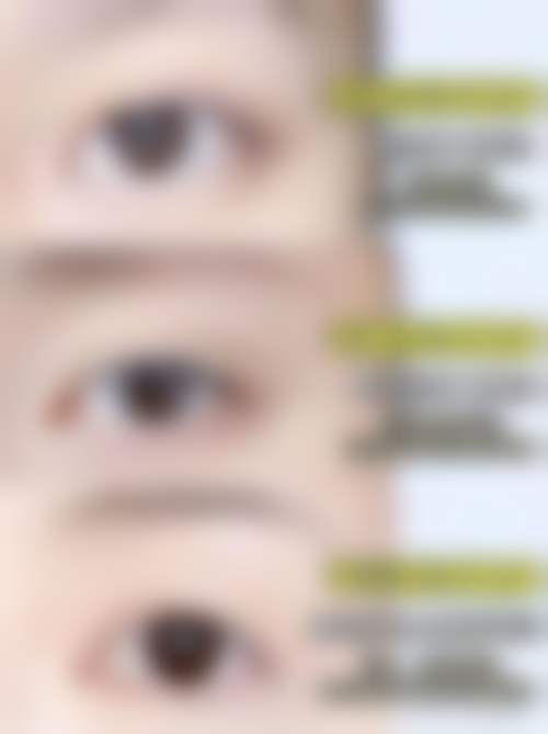 深圳阳光医疗美容医院张起准医生擅长项目