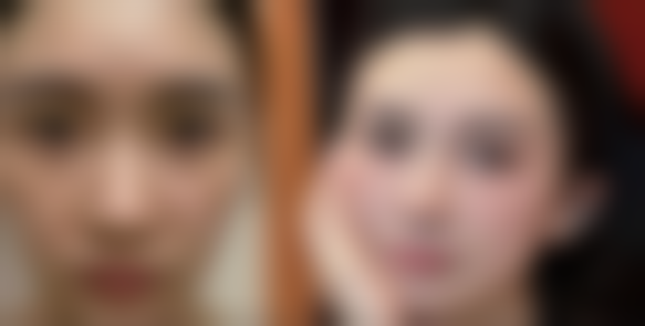 漳州维多利亚医疗美容门诊部陈淑端医生患者评价